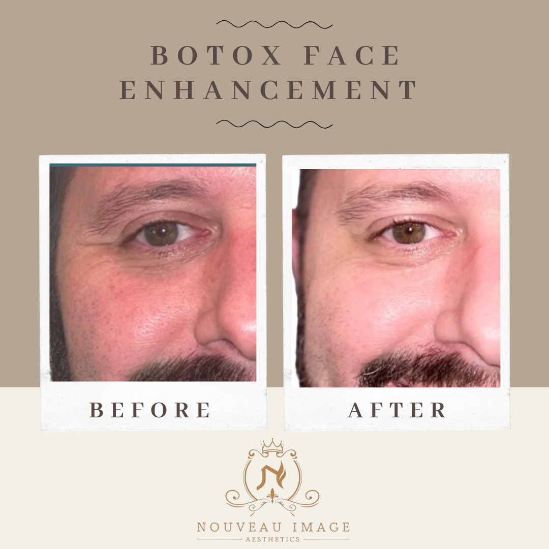 Copy of Neutral Modern Before and After Progress Instagram Post (1)
