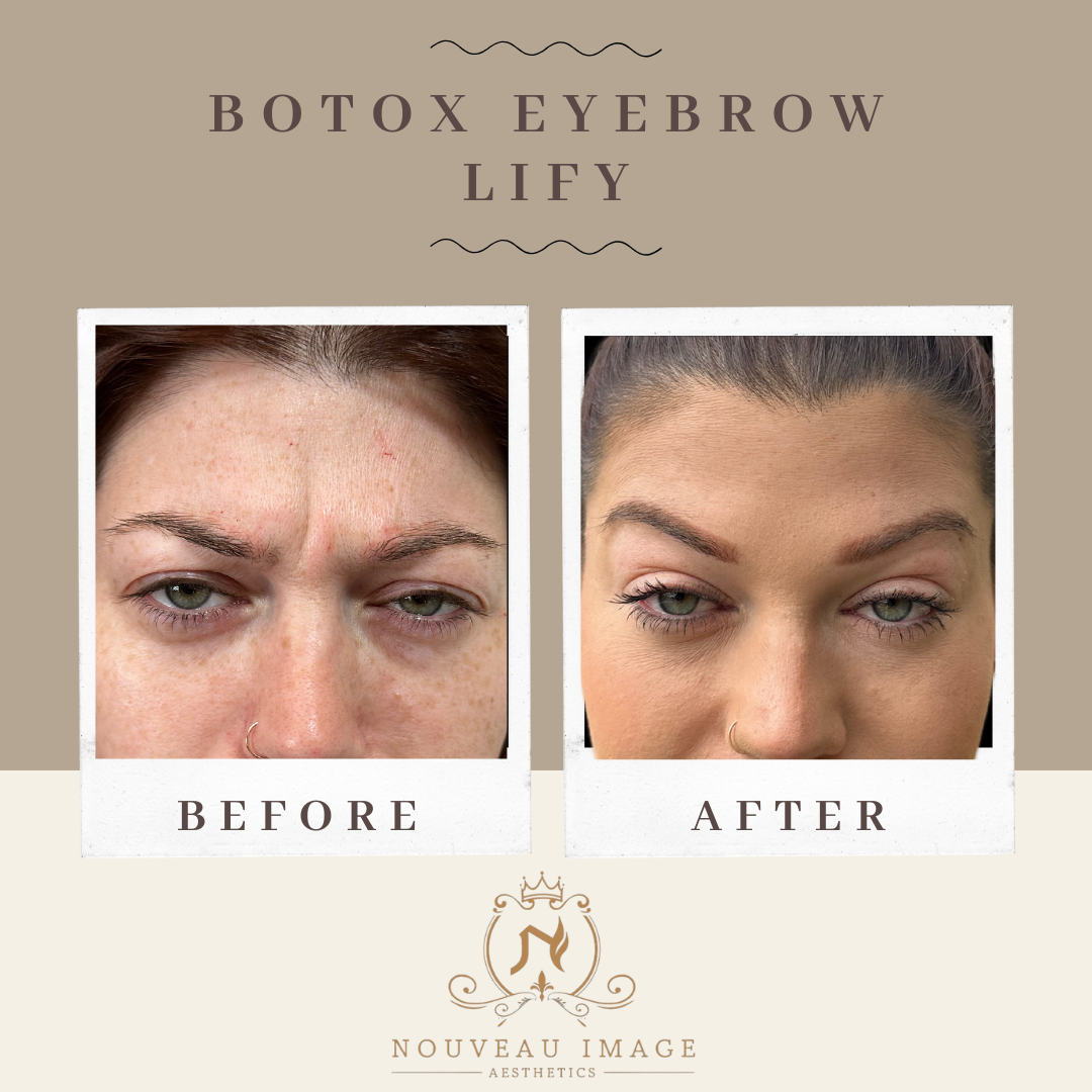 Copy of Neutral Modern Before and After Progress Instagram Post (2)