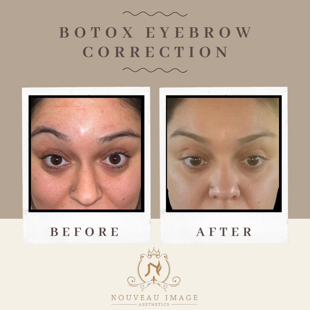Neutral Modern Before and After Progress Instagram Post - 6