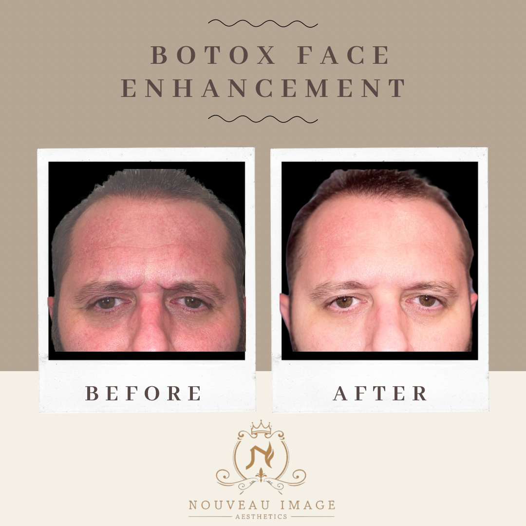 Neutral Modern Before and After Progress Instagram Post - 9