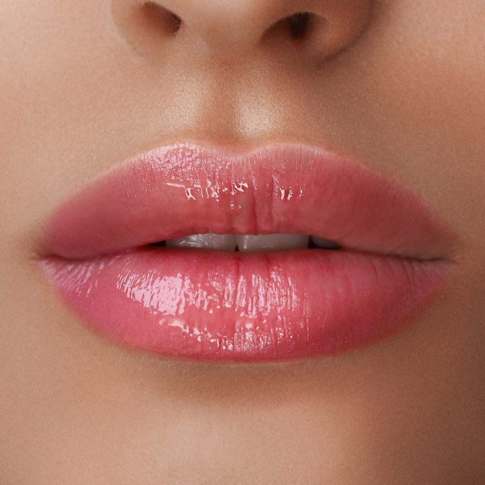 lips Cheek filler